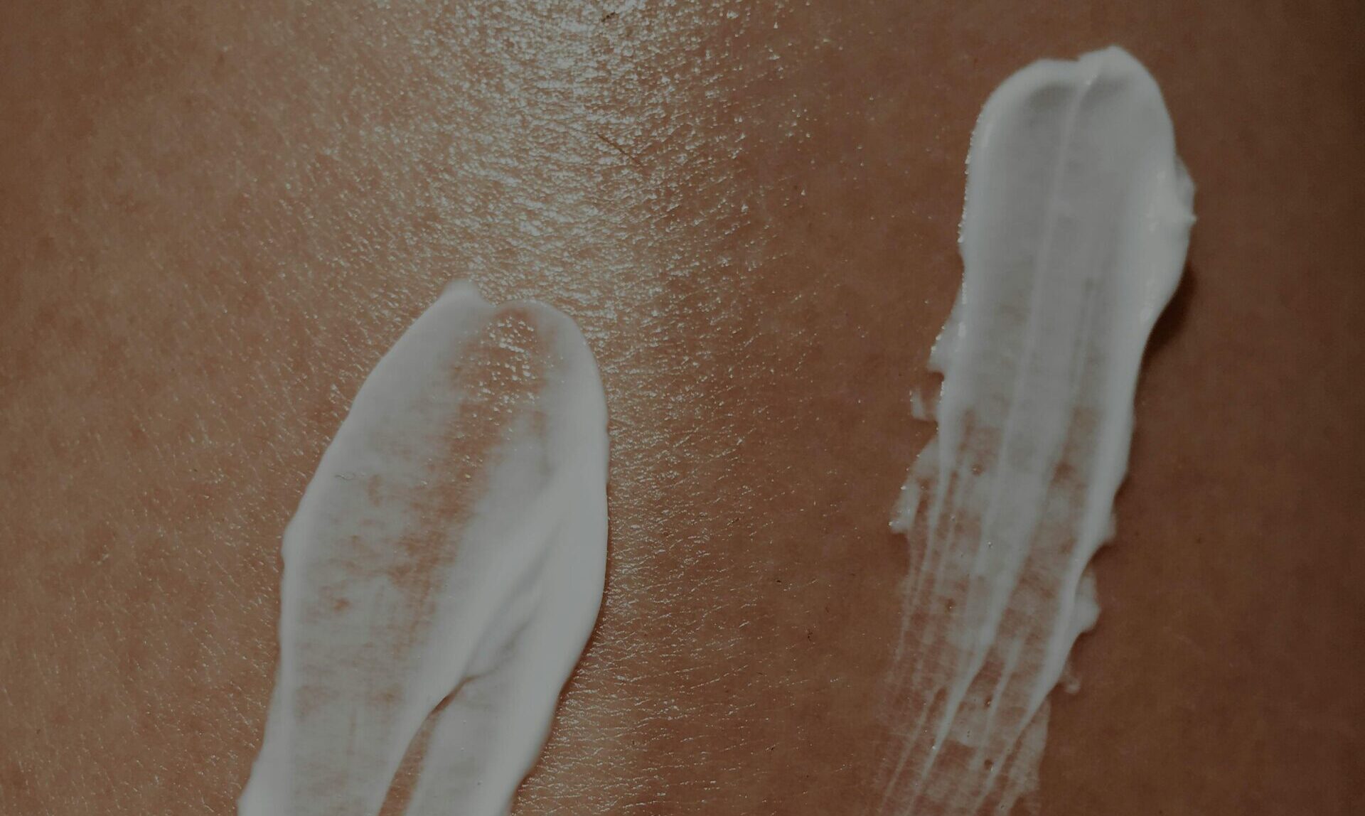 poskodovana:kozna_bariera03